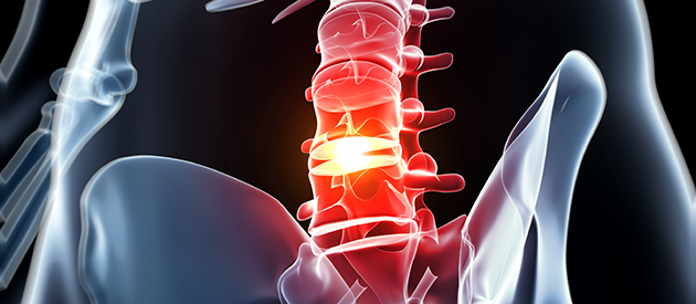 Occipital Neuralgia Treatment Darby PA | Media PA | Plymouth Meeting PA